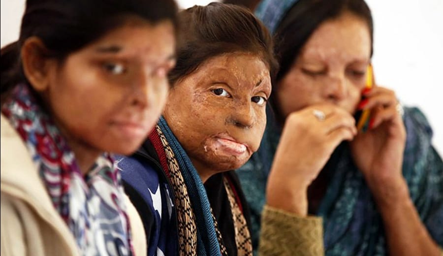 Acid Attack: Scars On India’s Face