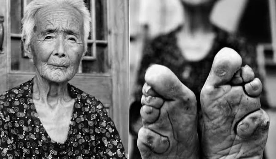 The Art of ‘Foot Binding’