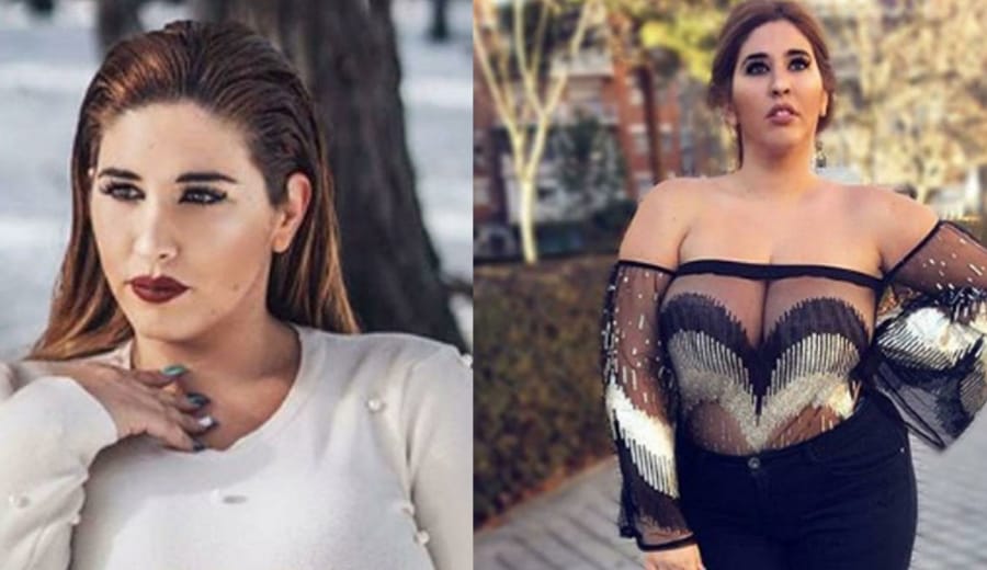 Honesty Makes Plus Size Model Lose 150,000 Followers